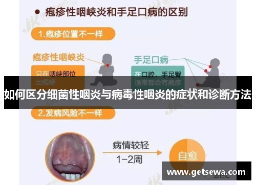 如何区分细菌性咽炎与病毒性咽炎的症状和诊断方法